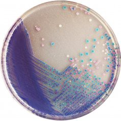 CHROMagar CHROMagar Salmonella - CAUQ0029-CHROMagar-Salmonella - 商品圖 1