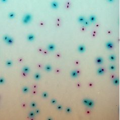 CHROMagar ECC CHROMagar-ECC 和更多型號 - 商品圖 2