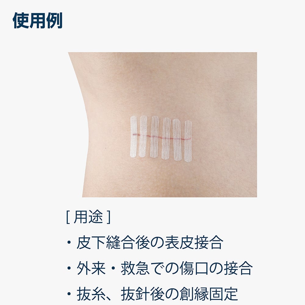 Navi Strip (皮膚接合膠帶) 6 x 38 毫米, 6 片 x 10 袋 及其他 SC638 和更多型號 - 商品圖 4